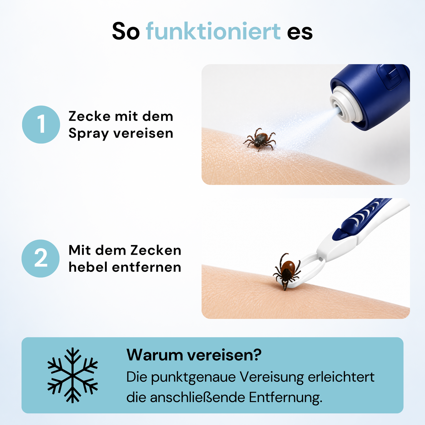 KICK THE TICK | Schmerzfreies & Sicheres Zeckenentferner Set mit Vereisungsspray und Zeckenzange