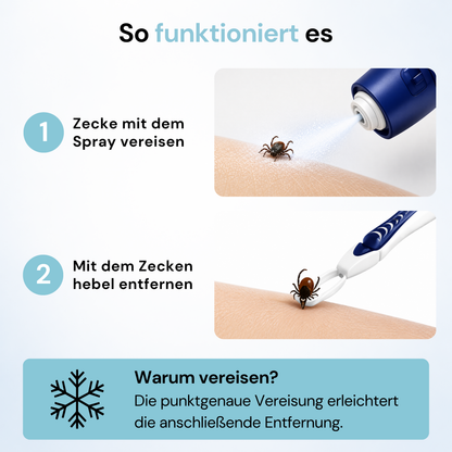 KICK THE TICK | Schmerzfreies & Sicheres Zeckenentferner Set mit Vereisungsspray und Zeckenzange